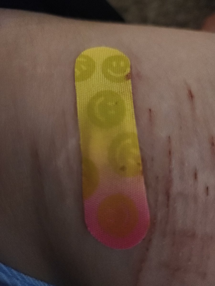 pringless_cann's tweet photo. the other cut didn't deserve the good looking bandaid so IT GOT THIS IM LAUGJING https://t.co/k5CHztsViC