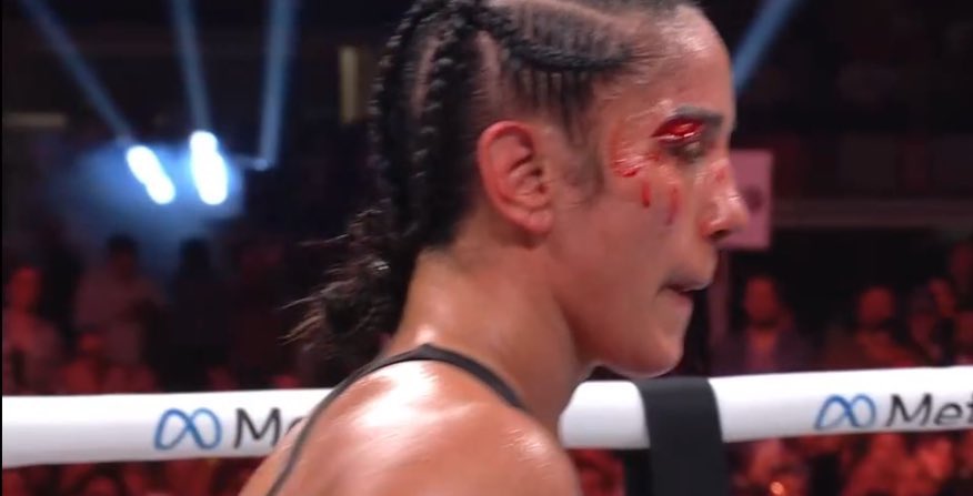 Dr. Glaucomflecken tweet media