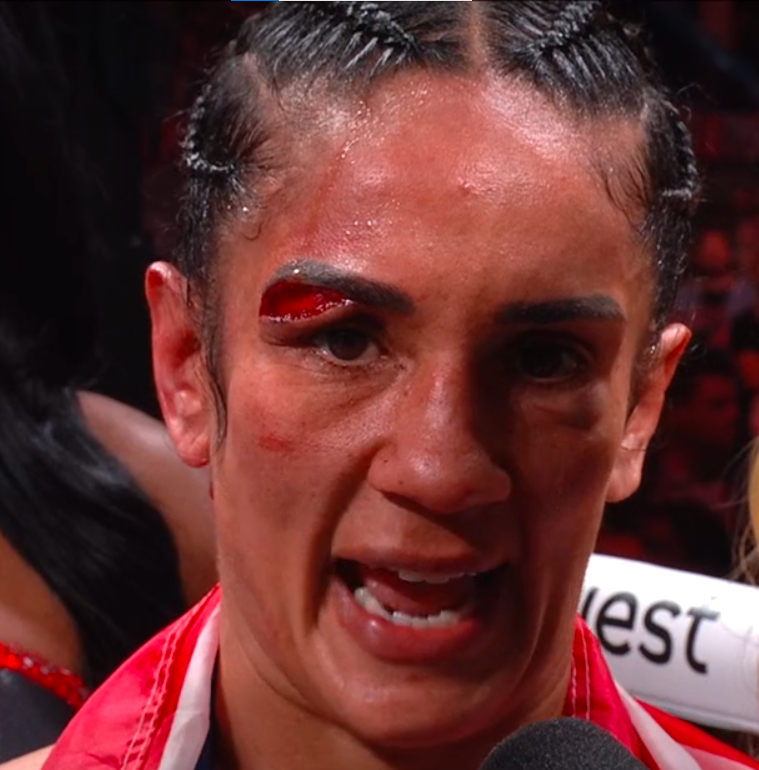 WAT A  WINNER ~ SHE WON OUR HEART !!! ♥️

#Boxing #PaulTyson #NetflixFight