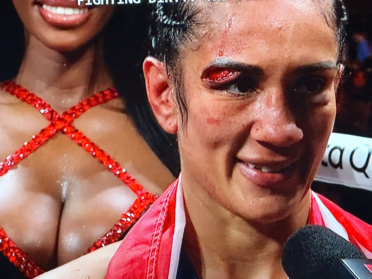 This is the winner of Netflix’s boxing event.