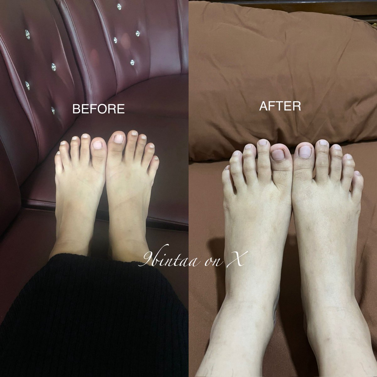 9bintaa's tweet photo. nemu bodycare yg mantep bgt buat ilangin belang, bikin cerah mulai 20rban aja. simak sampe abis🥹🫵🏻 https://t.co/xisivBpMOi