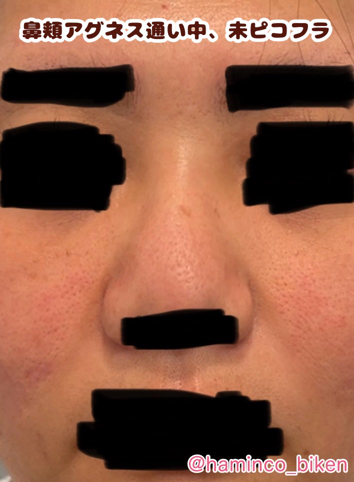 はみんこ@コスメコンシェルジュ/サプリや健康法を試す人 tweet media