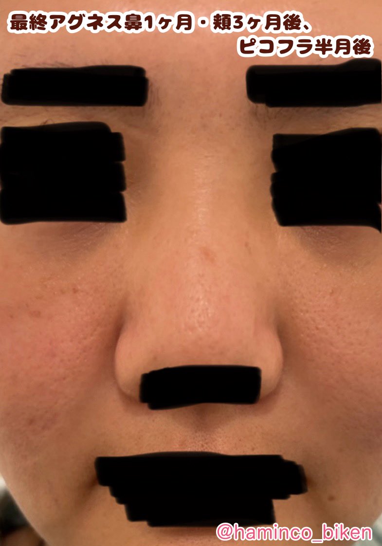 はみんこ@コスメコンシェルジュ/サプリや健康法を試す人 tweet media