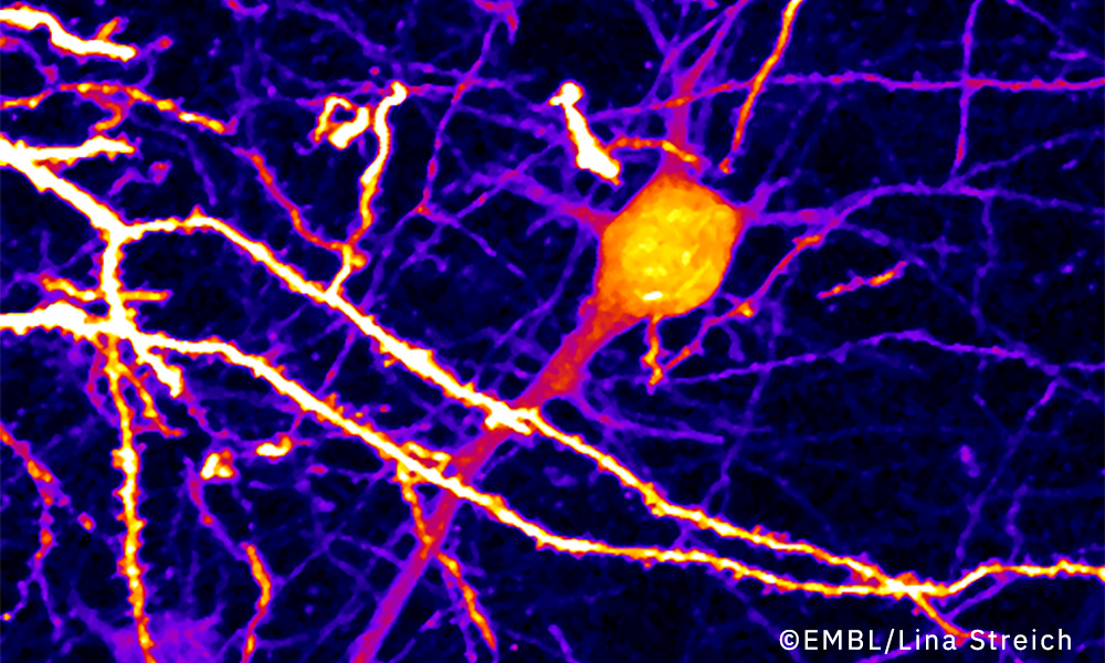 EMBL Science Education & Public Engagement (@ells_heidelberg) on Twitter photo 🔬Discover cutting-edge microscopy techniques and how they are revolutionising biology at this year’s #EMBLinsight Lecture! Don't miss this opportunity to see biology through a whole new lens!
📅 13.12.24
📍<a href="/EMBLHeidelberg/">EMBL Heidelberg</a> or Live stream
📌 Sign up now: embl.org/ells/insight-l… 🔬Discover cutting-edge microscopy techniques and how they are revolutionising biology at this year’s #EMBLinsight Lecture! Don't miss this opportunity to see biology through a whole new lens!
📅 13.12.24
📍<a href="/EMBLHeidelberg/">EMBL Heidelberg</a> or Live stream
📌 Sign up now: embl.org/ells/insight-l…