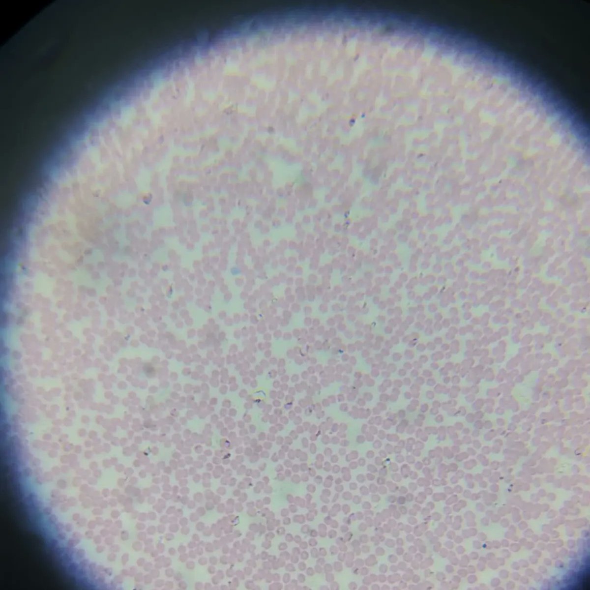 Noviembre es el mes de la ciencia en nuestras aulas, esta semana nos hemos llevado el lab a los domicilios para que nuestros pequeños científicos y científicas descubran el diminuto mundo que nos rodea 🔬🔬. ¡Seguimos investigando! 👏👏
<a href="/HUCA_Asturias/">@HUCA</a> <a href="/Educastur/">Consejería de Educación</a>