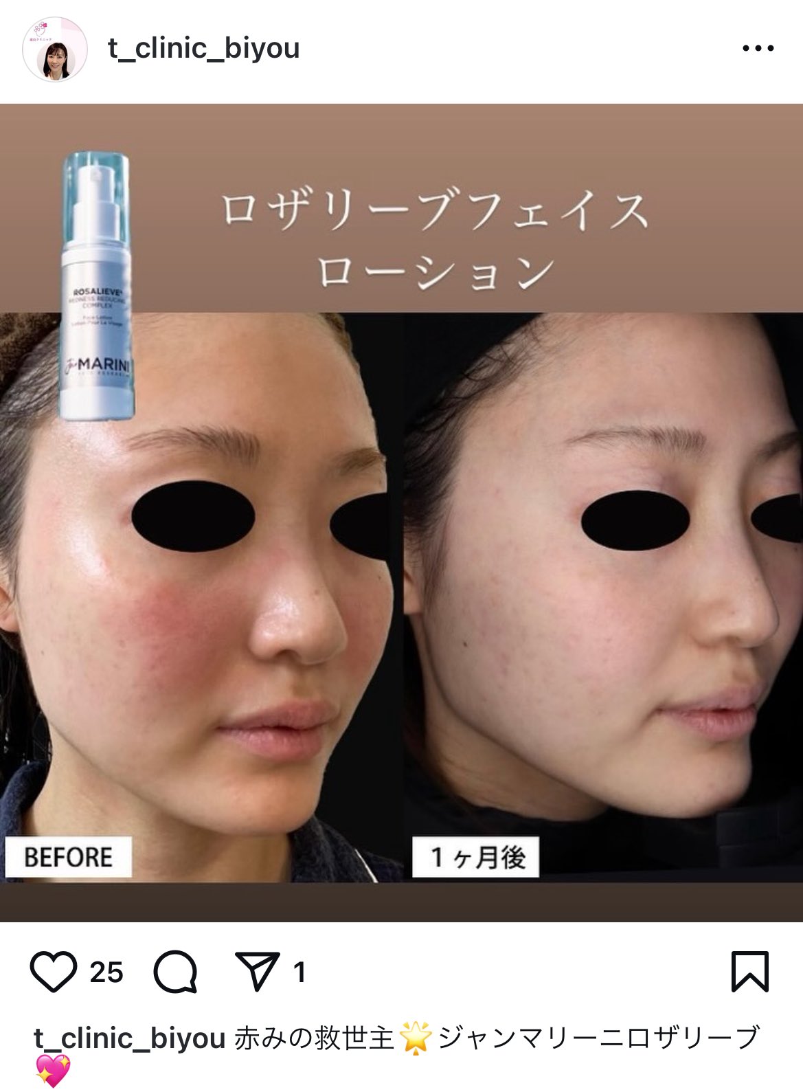 ロザリーブ フェイスローション ジャンマリーニ 【公式通販】