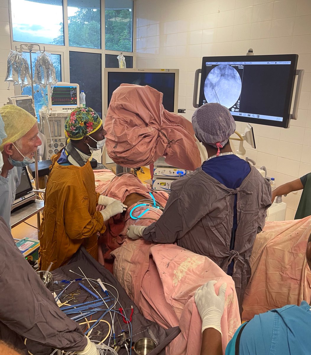MatthewTrail's tweet image. Incredibly rewarding week in Hawassa 🇪🇹 with the #Urolink team - 11 PCNLs in 4 days with excellent progress by the local team and an inaugural national bootcamp for trainees - exciting times ahead for Ethiopian Urology! @MrWillFinch @shekharbiyani @BAUSendourology @BJUIjournal