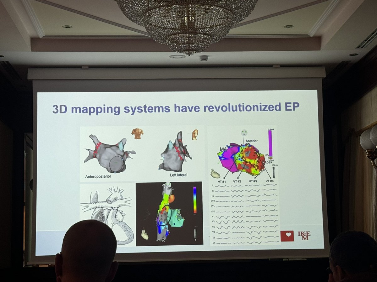 Carlos Minguito (@carlosminguito) on Twitter photo Amazing advanced #VT #EHRA course at Milan. Incredible lectures and a lot of take home messages <a href="/EladAnter/">Elad Anter</a> <a href="/AndreaSarkozy/">Andrea Sarkozy</a> <a href="/Cardioschool/">Maxim Didenko, MD PhD</a> <a href="/ivroca/">Ivo Roca, FEHRA, FESC</a> <a href="/martaderiva/">Marta de Riva</a> <a href="/Petr_Peichl/">Petr Peichl</a> <a href="/EPDeneke/">Thomas Deneke</a> Amazing advanced #VT #EHRA course at Milan. Incredible lectures and a lot of take home messages <a href="/EladAnter/">Elad Anter</a> <a href="/AndreaSarkozy/">Andrea Sarkozy</a> <a href="/Cardioschool/">Maxim Didenko, MD PhD</a> <a href="/ivroca/">Ivo Roca, FEHRA, FESC</a> <a href="/martaderiva/">Marta de Riva</a> <a href="/Petr_Peichl/">Petr Peichl</a> <a href="/EPDeneke/">Thomas Deneke</a>