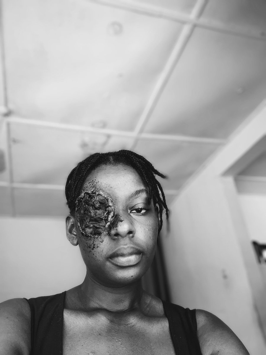doxalenny's tweet photo. PLUCK - IT - OUT 👁️
This took me an hour to complete and here's how it turned out.
.
.
#sfxmakeuptz #doxalenny #fakewound https://t.co/EGE8g6HxZZ
