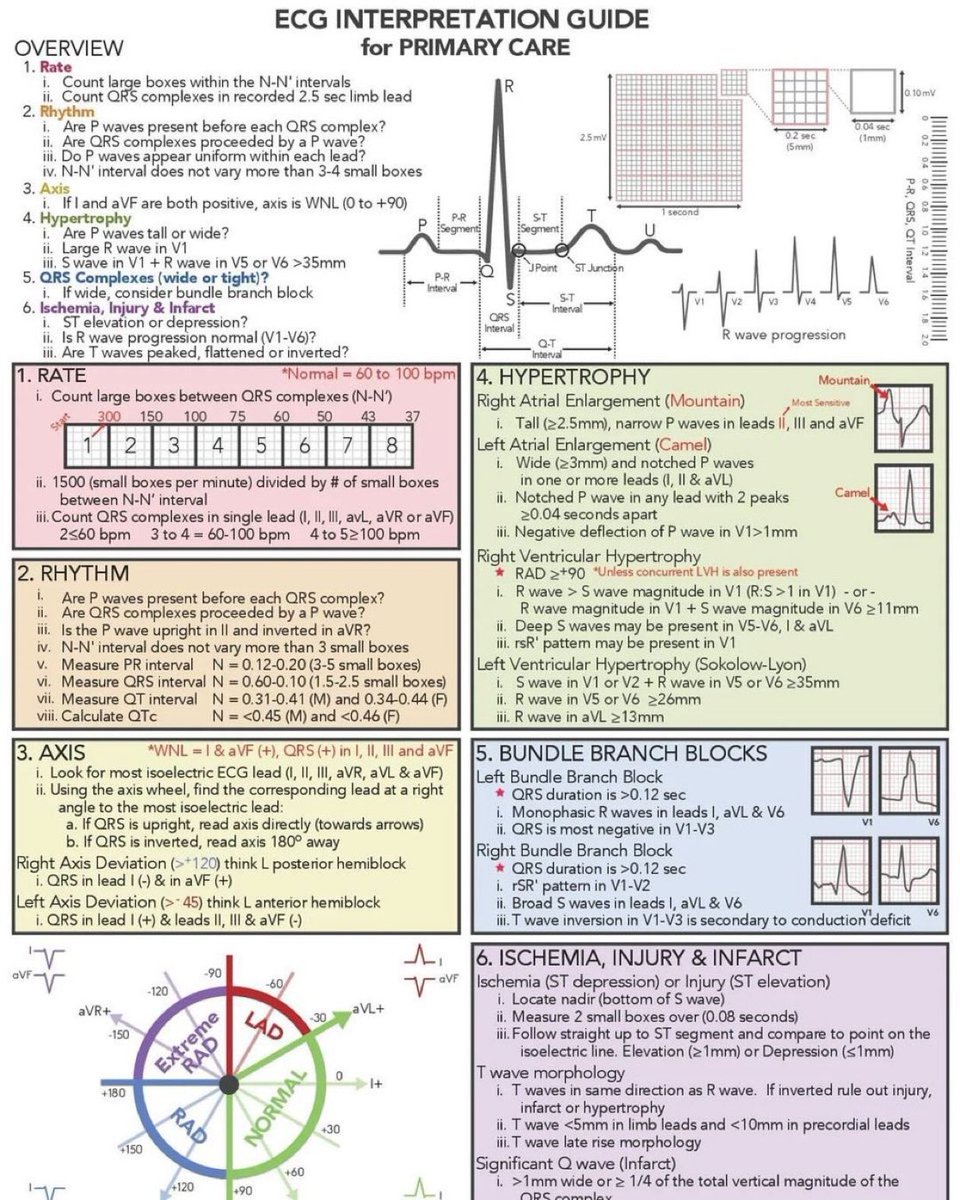Doctors__squad's tweet photo. ECG Made Easy !💪💪💪 https://t.co/jSKmdX1Q0s