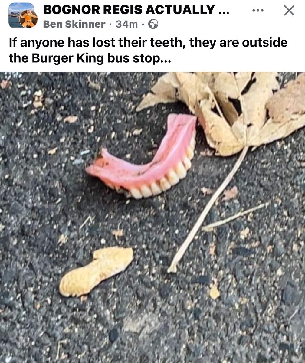 Missing teeth #bognor