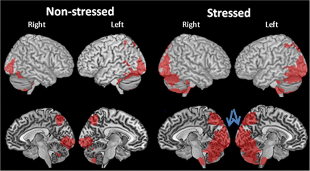 The most dangerous, common, and overlooked problem in the world:

Stress.

It's the reason why you're depressed, anxious, and have panic attacks.

Here is Andrew Huberman's 7-step protocol to beat stress (for good):