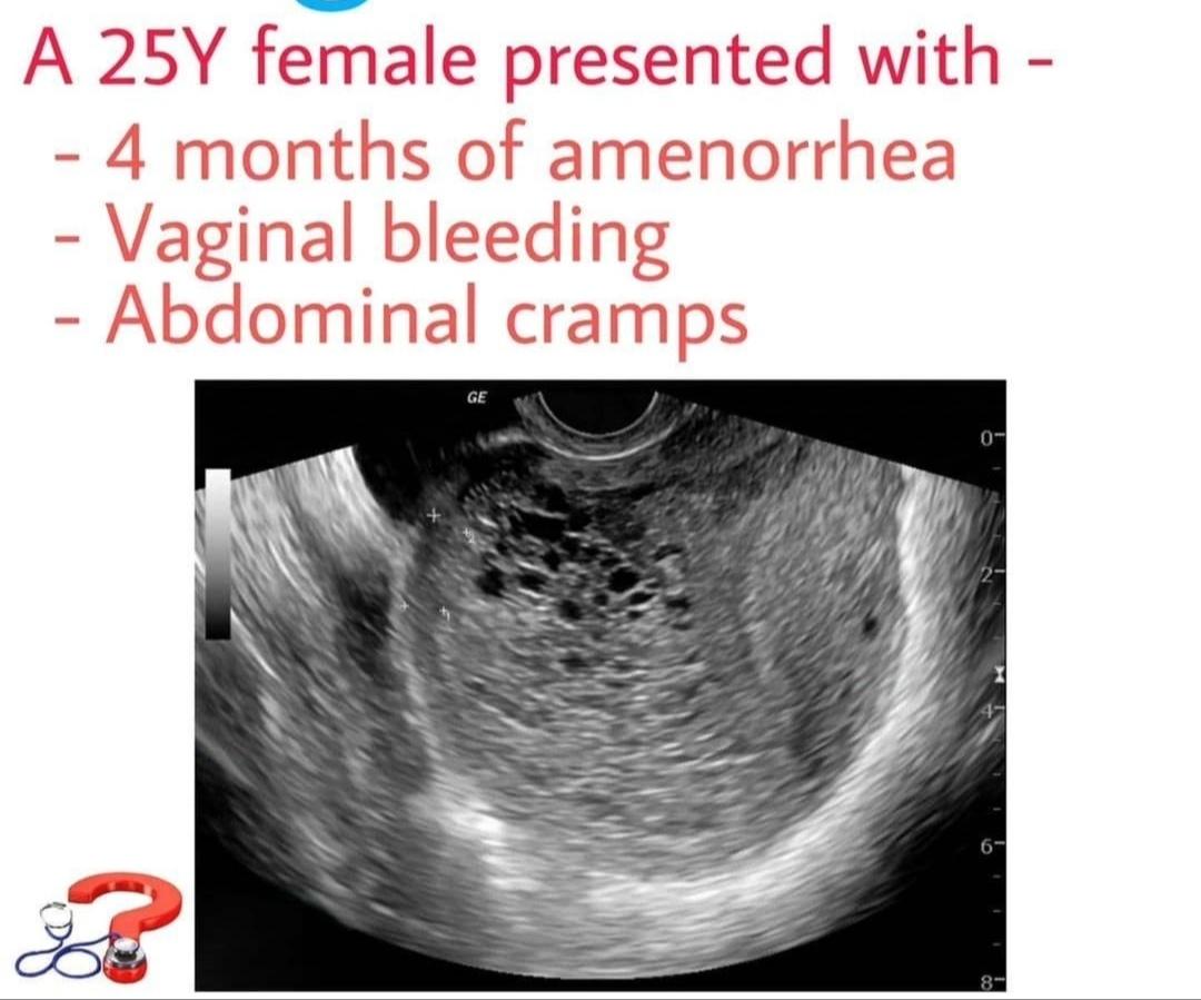 DrArslan480's tweet photo. What's your diagnosis??? https://t.co/k8sFR0ZPas