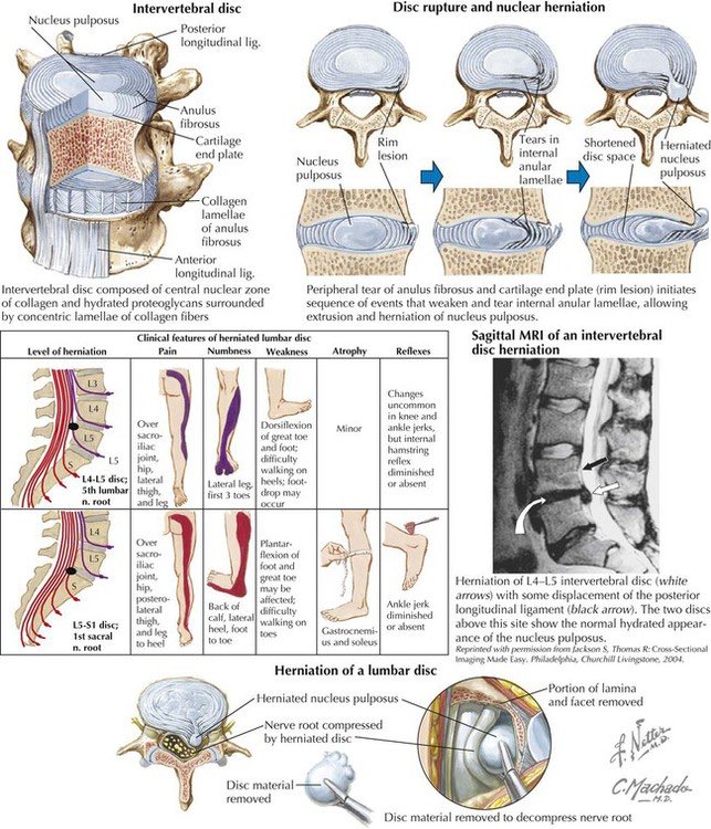 Oren Gottfried, MD tweet media