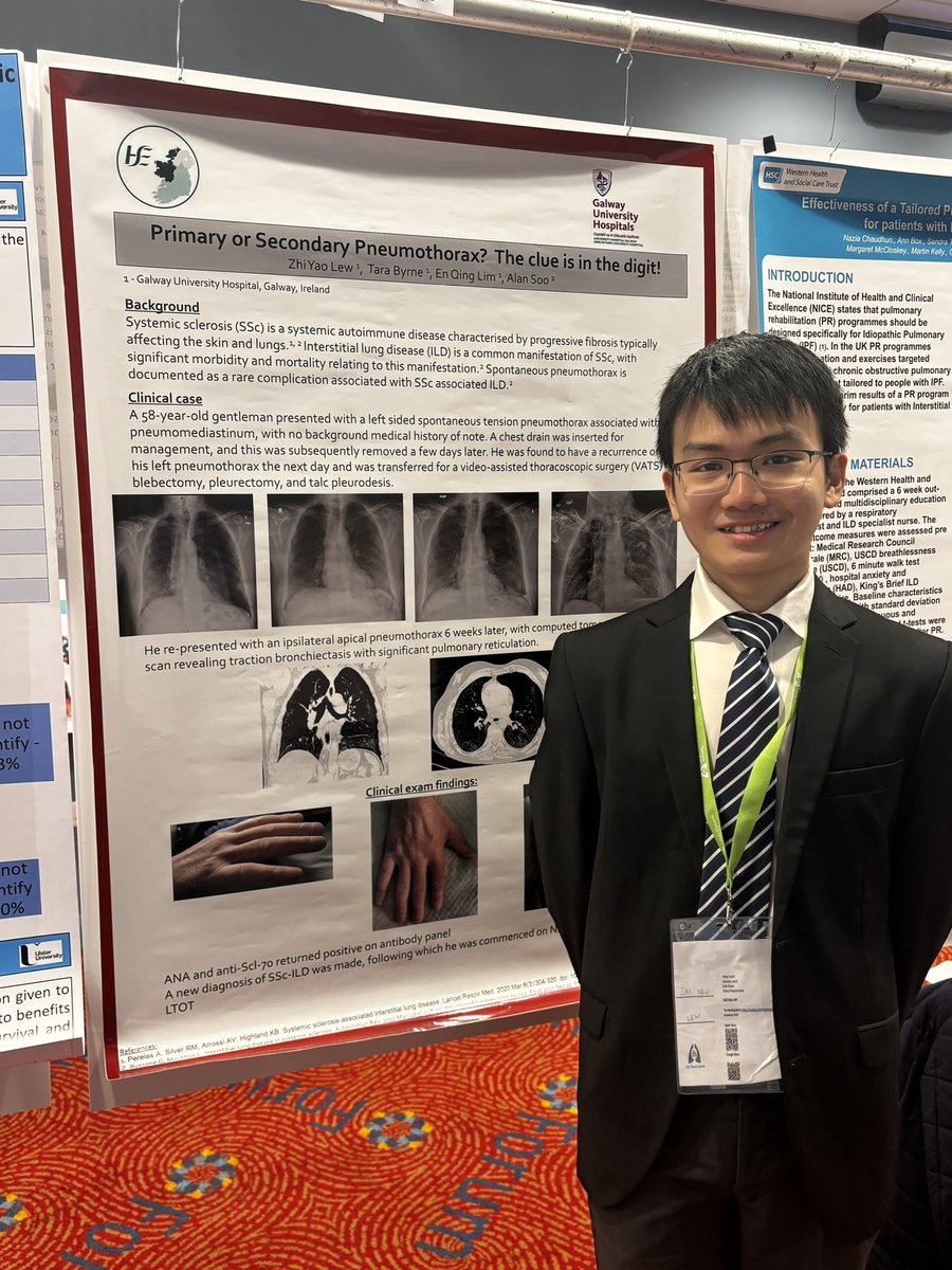 ProfAlanSoo's tweet image. Delighted to have Dr Zhi Liew and @Tara_CTANP present some interesting  Cardiothoracic/Respiratory cases @irishthoracicS . Always a pleasure to collaborate with Respiratory Colleagues to ensure optimal patient outcomes @HSE_West_NWest #PatientCare