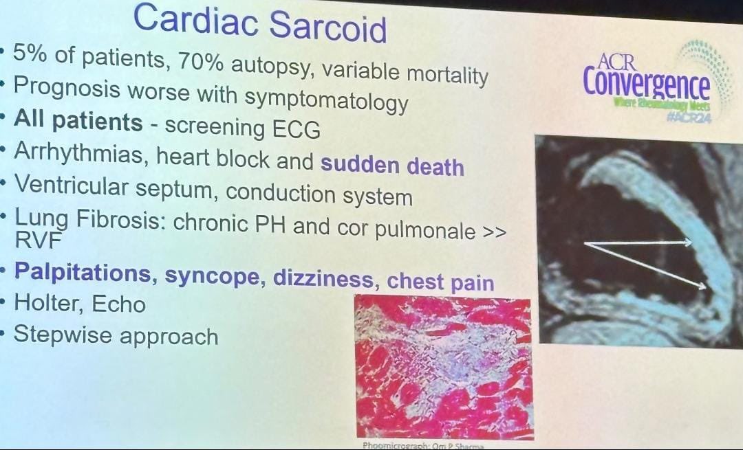 Rheumat_Aravind's tweet photo. Cardiac Sarcoidosis
#ACRReview #ACR2024
@DrAkhilX https://t.co/SvMX4v5hvA