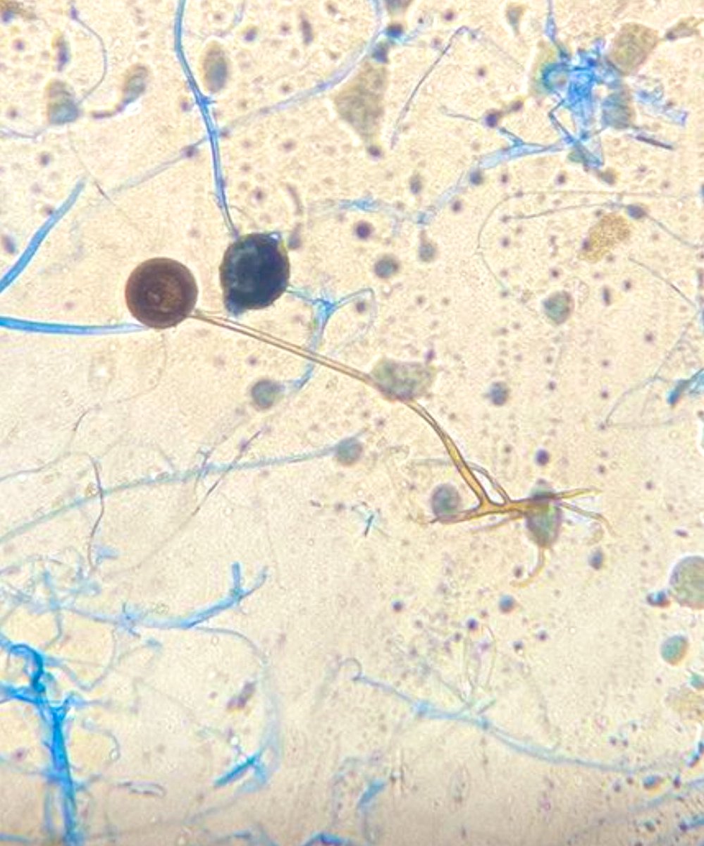 Imagen del día: Rhizomucor sp.