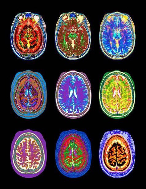 eagy_'s tweet photo. Un cerebro adicto es un cerebro roto.

Si estás luchando con alguna adicción y quieres hacer algo al respecto...

Aquí está el protocolo de “Andrew Huberman” para superar la adicción.

– Hilo – https://t.co/wQfMuwlPwY