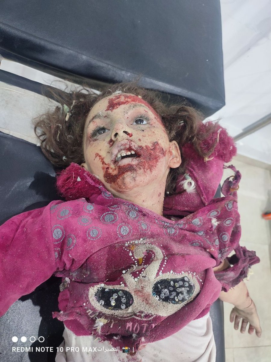 ARAFET_Abdullah's tweet photo. The US administration's criminal policy of denying the genocide in Gaza confirms its responsibility for the heinous war crimes.
#DenzelBurke #TravisHunter #Heisman
#Quinn #Clemson #Arkansas #HookEm
#CamColeman #Colorado #SCUTO #Northwestern #IsaacWilson #Tulane #NWSL #Sark https://t.co/bvfcNbeEa9