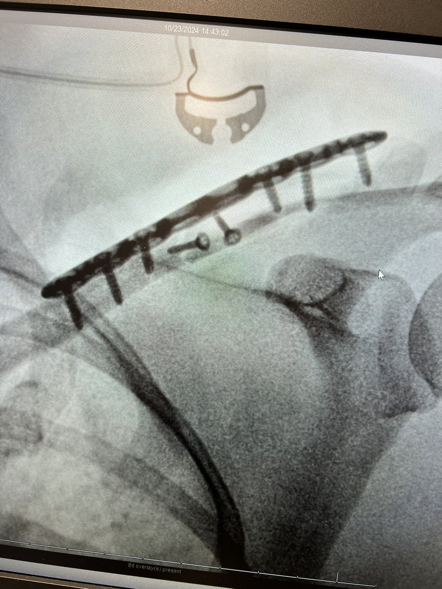 daleybones15's tweet photo. Updates from the trenches of Orthopaedic Surgery residency: 
1. Orthopedics is very, very cool.
2. Yes, I’m alive.  
3. To the #match2025 applicants- yes, it’s worth all of the hard work.  
#orthotwitter https://t.co/IgbTxF1dyc