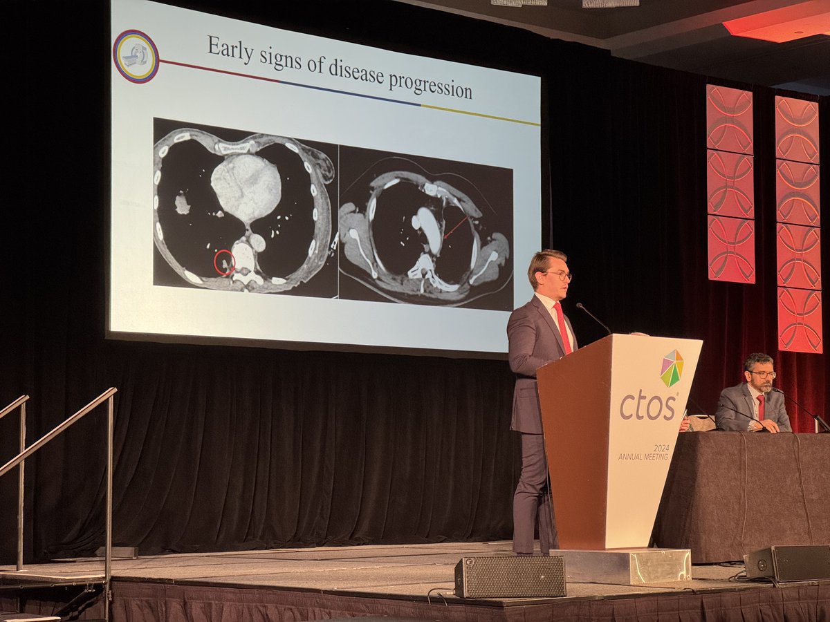 Alessandro Gronchi (@alegronchi) on Twitter photo <a href="/Andrea_Vanzulli/">Andrea Vanzulli</a> presenting a proposal for modified RECIST criteria - the RESCOR criteria - to assess Hepithelioid Hemangioendothelioma response to therapies and clinical course! Very nice and clear presentation. Well done Andrea! We are so lucky to have you! <a href="/IstTumori/">Istituto Tumori</a> <a href="/Andrea_Vanzulli/">Andrea Vanzulli</a> presenting a proposal for modified RECIST criteria - the RESCOR criteria - to assess Hepithelioid Hemangioendothelioma response to therapies and clinical course! Very nice and clear presentation. Well done Andrea! We are so lucky to have you! <a href="/IstTumori/">Istituto Tumori</a>