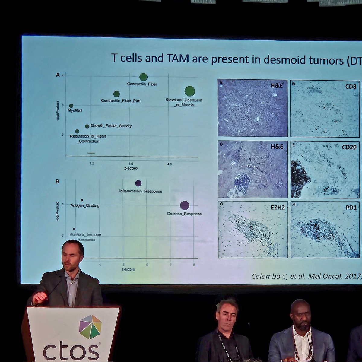Marco Fiore, MD, FACS, FEBSh (@fioredoc) on Twitter photo #CTOS2024 Progression / spontaneous regression in #desmoid on active surveillance may be related to altereted immune profiles in peripheral blood - stimulating insight from <a href="/sandro_pasquali/">Sandro Pasquali</a> <a href="/IstTumori/">Istituto Tumori</a> <a href="/ChirSarcomi_INT/">Chirurgia dei Sarcomi INT</a> #ChiaraColombo #CTOS2024 Progression / spontaneous regression in #desmoid on active surveillance may be related to altereted immune profiles in peripheral blood - stimulating insight from <a href="/sandro_pasquali/">Sandro Pasquali</a> <a href="/IstTumori/">Istituto Tumori</a> <a href="/ChirSarcomi_INT/">Chirurgia dei Sarcomi INT</a> #ChiaraColombo