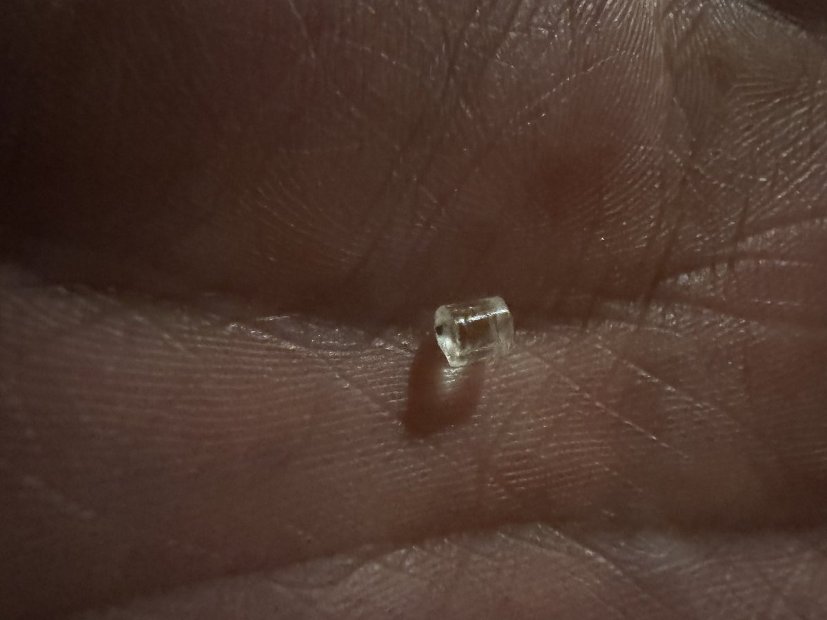 SuttySmash's tweet photo. @OreIdaPotatoes purchased this bag of fries from Costco. Cooked and fed them to my family. As I took a bite I felt something hard in my mouth and found a small piece of plastic. What is this? I’m furious as this could have gone to my kids! https://t.co/DHl7K8Ur4y