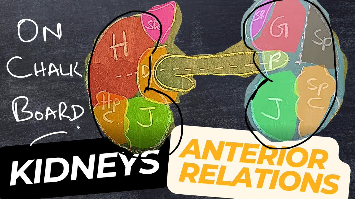 Chalkboard diagrams are a powerful tool for teaching spatial anatomy! Here's a video I created explaining the anterior relations of the kidney—breaking down a complex topic step by step for better understanding. Check it out!
#Anatomy
youtu.be/TigV41OSv68?si…