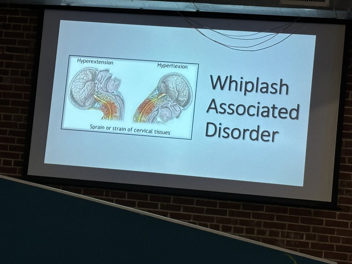 Day 2 of the spinal manipulation institute kicked off with advanced mechanisms behind pain &amp; presentations of whiplash associated disorder, headaches, &amp; TMJ management! Some minds blown today &amp; lots of clinicians starting to think about opening their own practice with this info!
