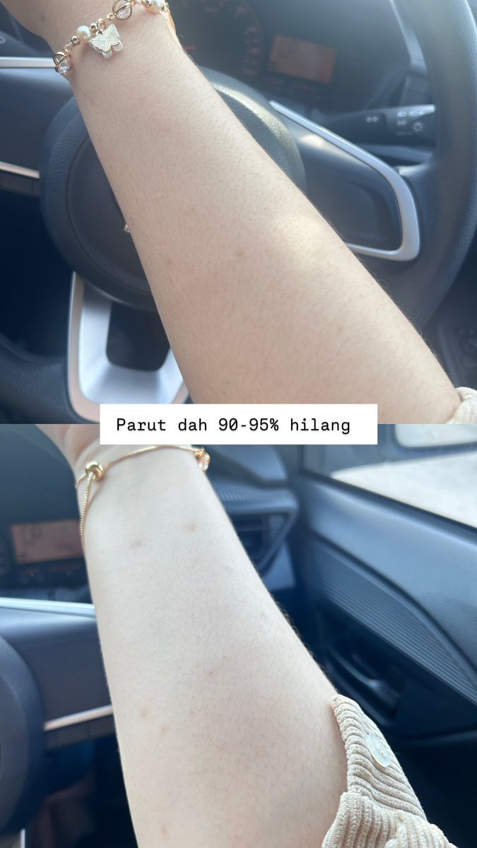 Satu je i nak cakap! Kalau i boleh, YOU PUN BOLEH.