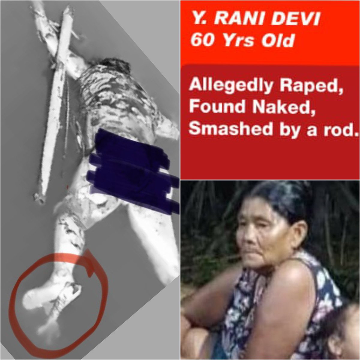 ATGCantFoolMe's tweet photo. ‼️ MURDER OF HUMANITY‼️ The first visual of Y. Rani Devi has surfaced online—a 60-year-old woman, naked-stripped of her dignity, her feet torn apart. This barbaric act forces us to ask: What horrors have other victims endured?
#KukiBabyKillers 
#Justice4MeiteiHostages https://t.co/2cyKyWOBCK