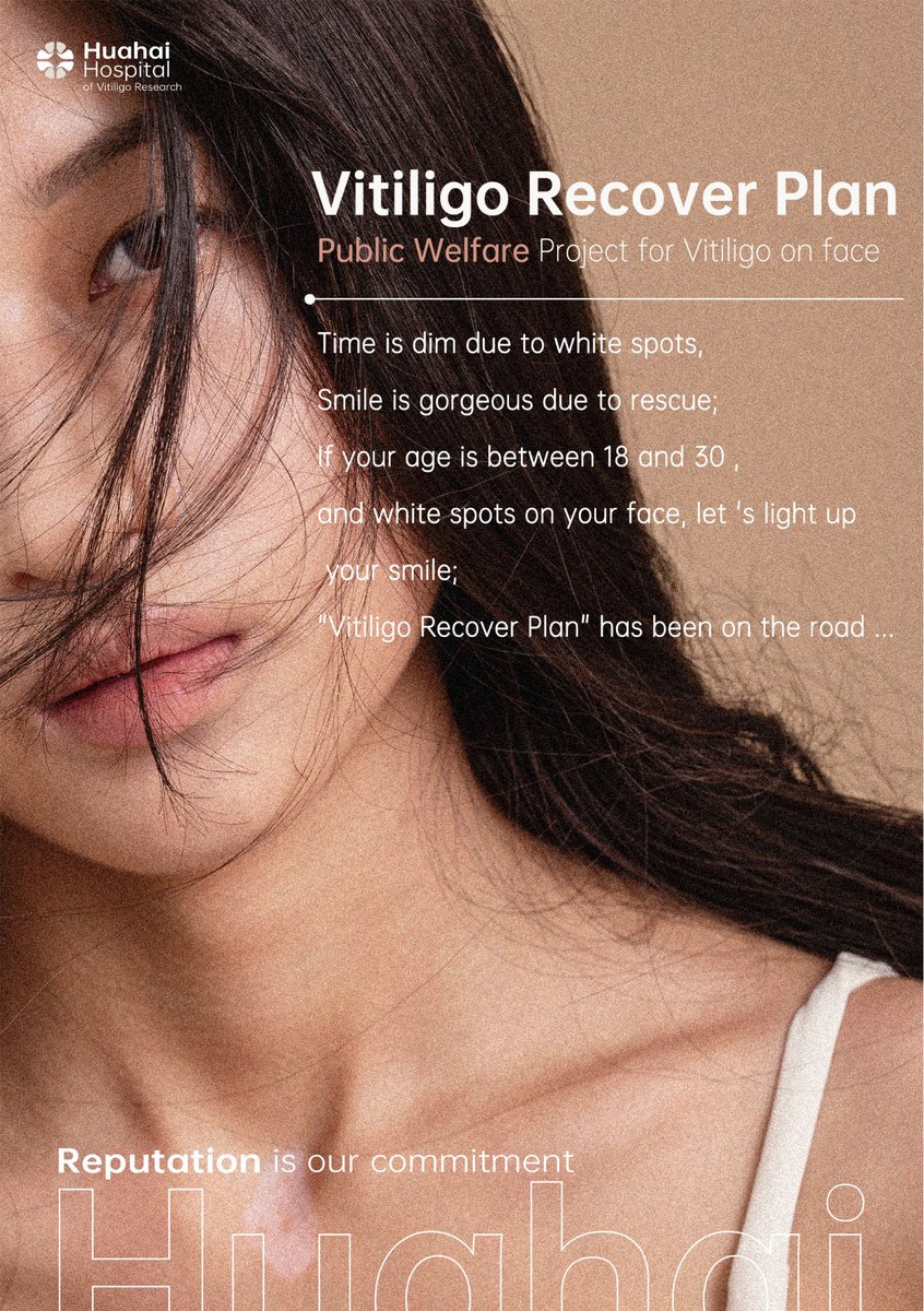 #vitiligo