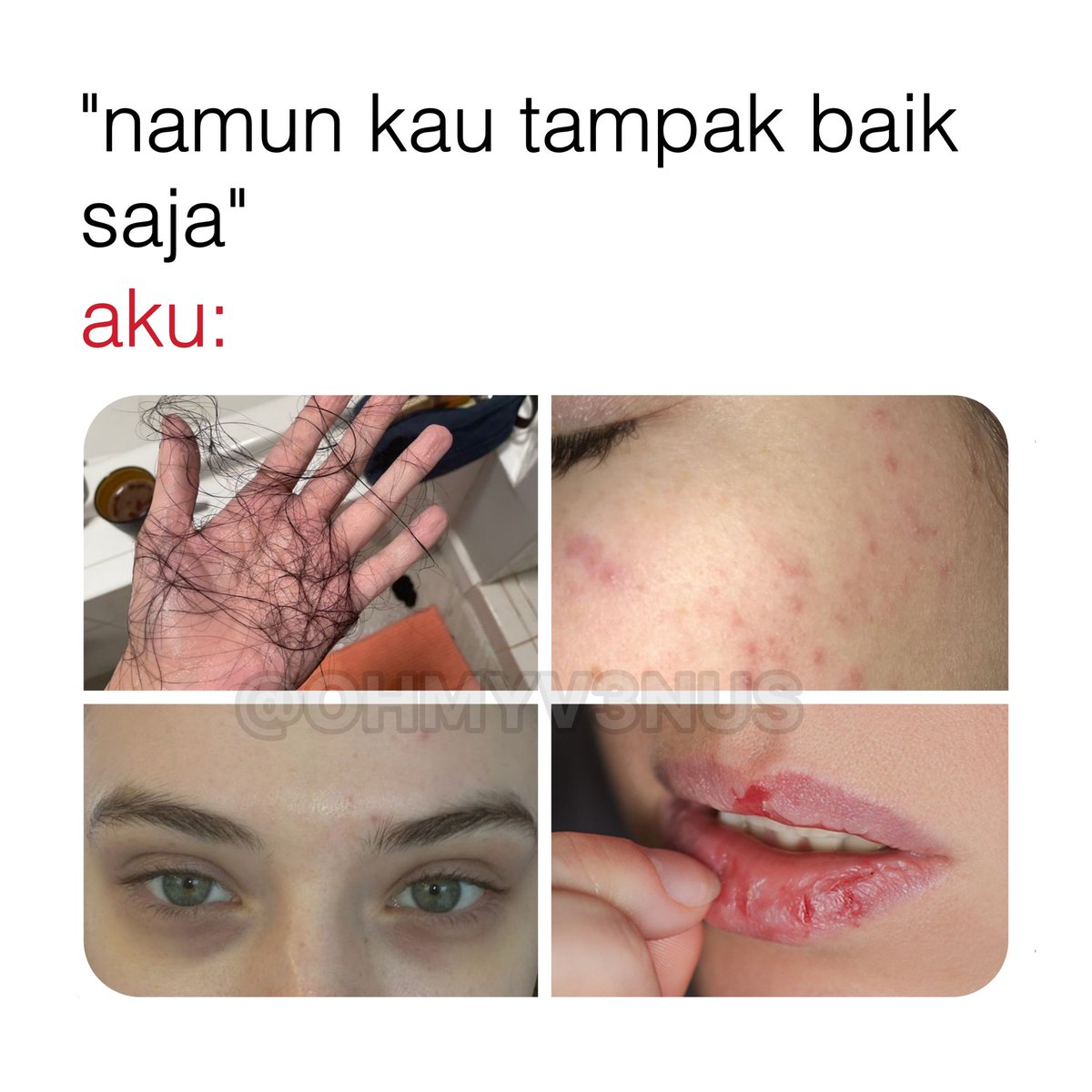 OHMYV3NUS's tweet image. 