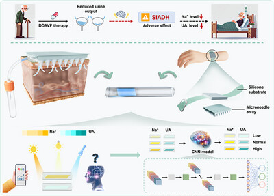 AggregateOA's tweet image. Early View💡
"A smart lab on a wearable #microneedle patch with convolutional neural network-enhanced colorimetry for early warning of syndrome of inappropriate antidiuretic #hormone secretion" by Jianlong Wang, Lei Su &amp;amp; Xueji Zhang et al. @WileyBiomedical #CNN #POCT