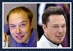 TaylorIndiana's tweet photo. @TheStandardNFT @elonmusk #Hairplugs https://t.co/XoZ6B7NBXz