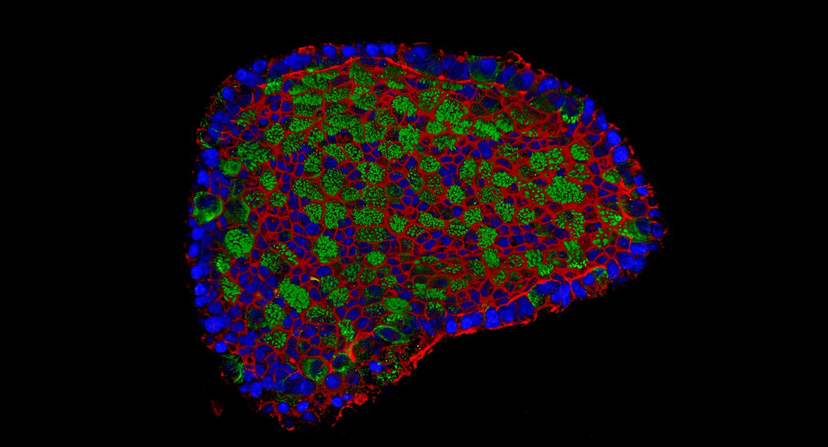 <a href="/Roche/">Roche</a>
's Institute of Human Biology (IHB) is looking for stellar junior/senior group leaders! Well-funded, independent positions for basic research on #HumanModelSystems #Organoids, with an eye for translation to drug development. Info:  go.roche.com/11jc8 #TeamIHB #pRED