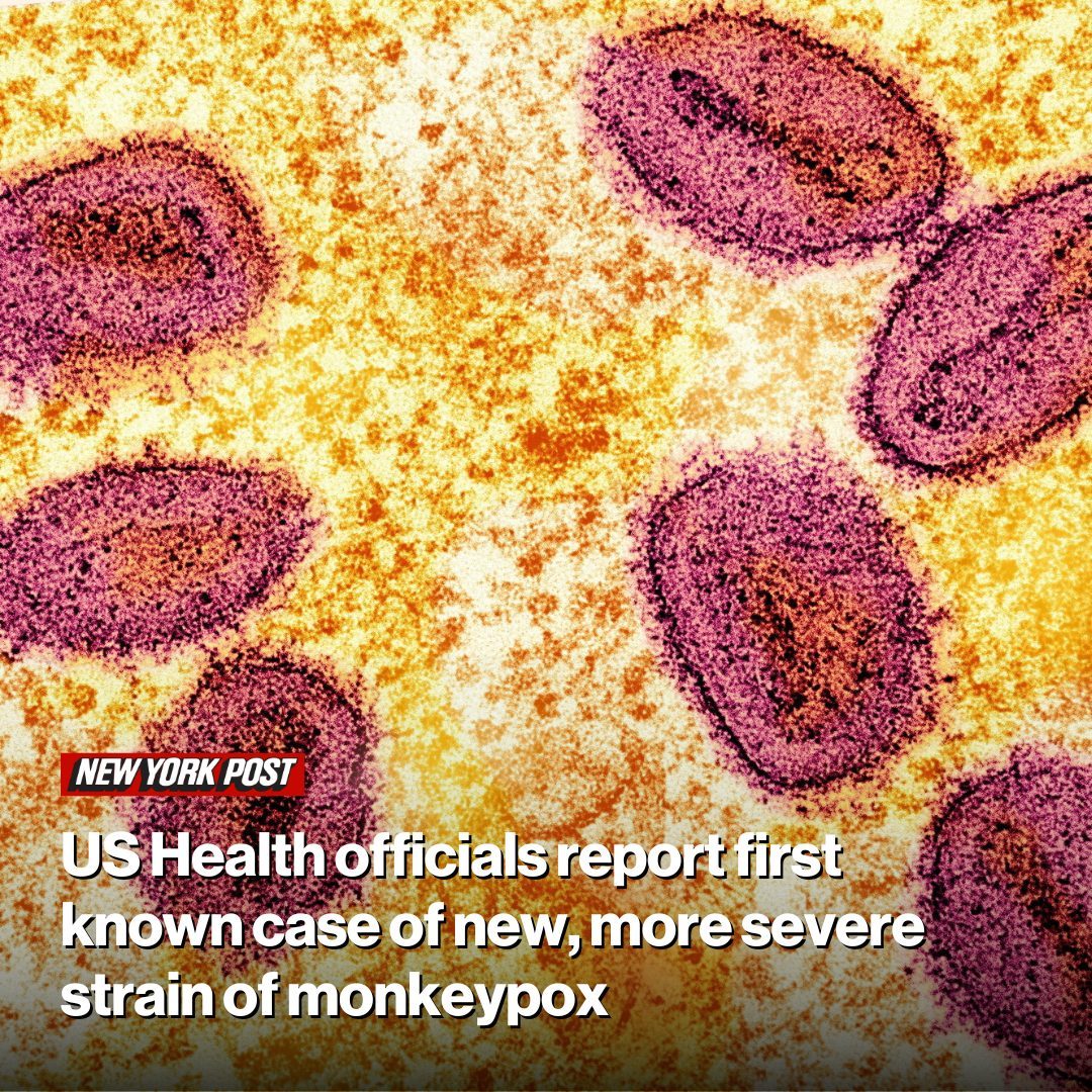 KristyTallman's tweet photo. BIOCHEMICAL WARFARE 🚨 First U.S. case of a severe strain of #Monkeypox confirmed in #California. Health officials report the individual recently returned from #Africa and contracted this more dangerous form of the virus.
#HealthAlert #InfectiousDisease #MonkeypoxUpdate #CaliforniaNews #PublicHealth #VirusUpdate #GlobalHealth #Africa #DiseaseControl #StayInformed