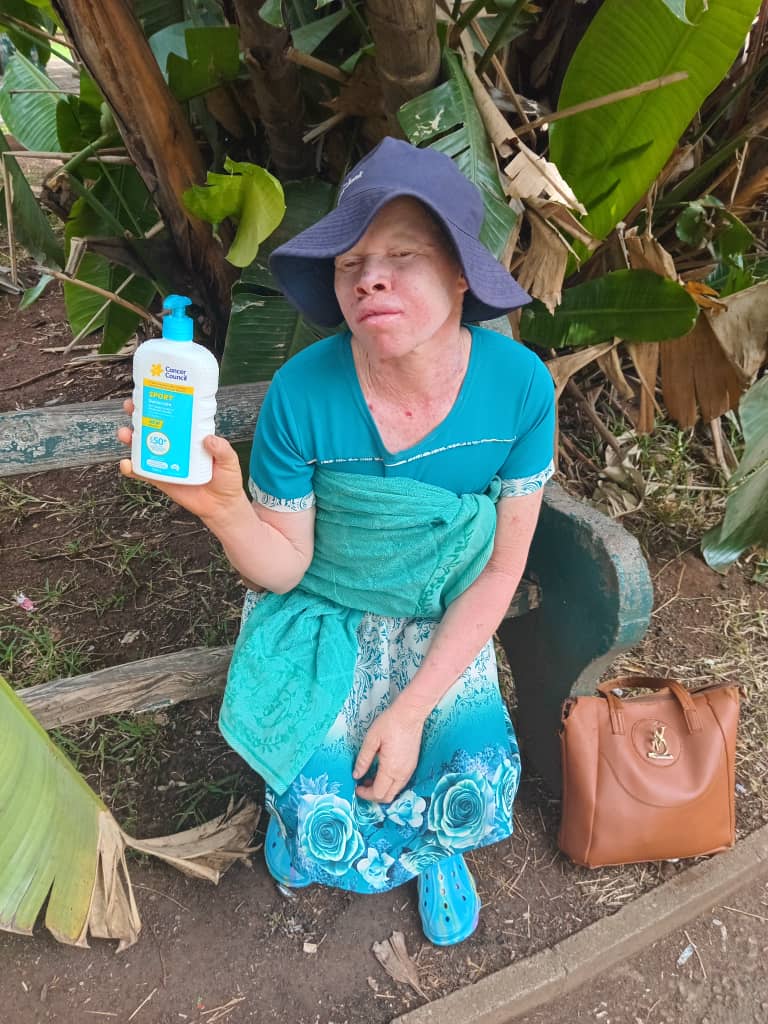Albinism Konnect touching lives as far as Nyamapanda. Support the cause to help us save lives