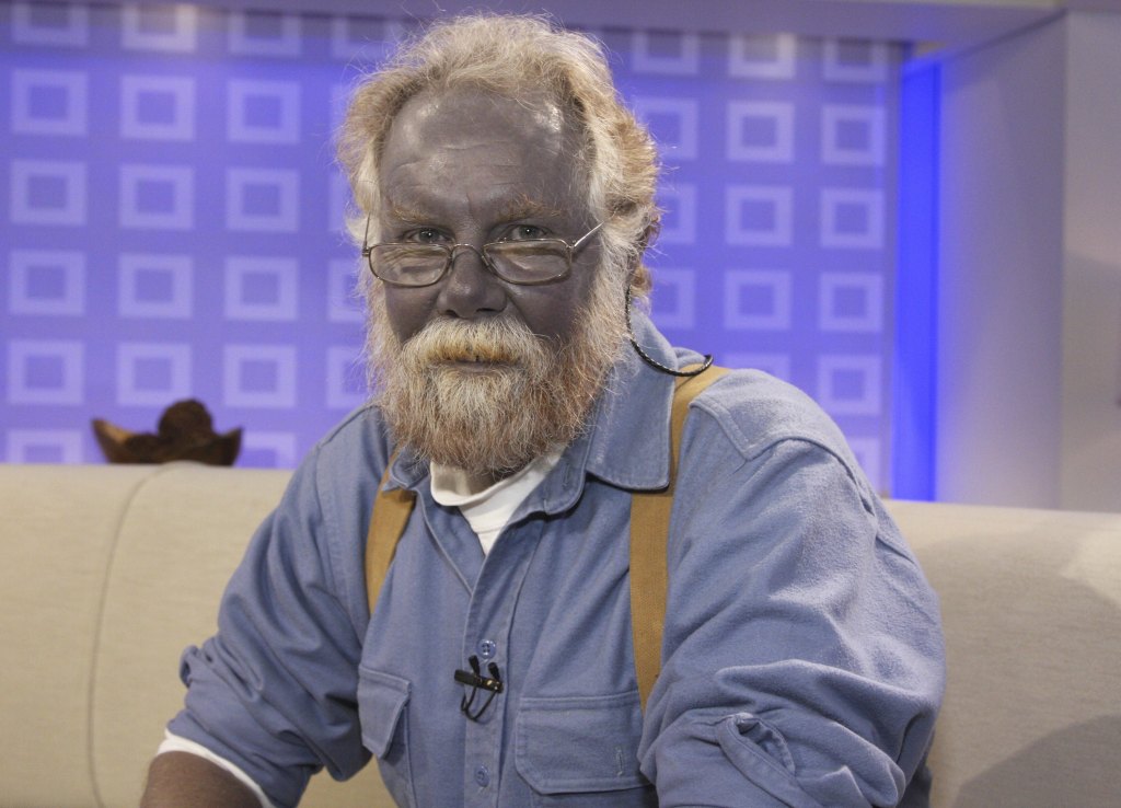 CosmoWenman's tweet image. You know what I miss in crank politicians with outsider idiot wisdom? Blue skin from colloidal silver. There are big shoes to fill, but RFKJR seems like he's up to the task.