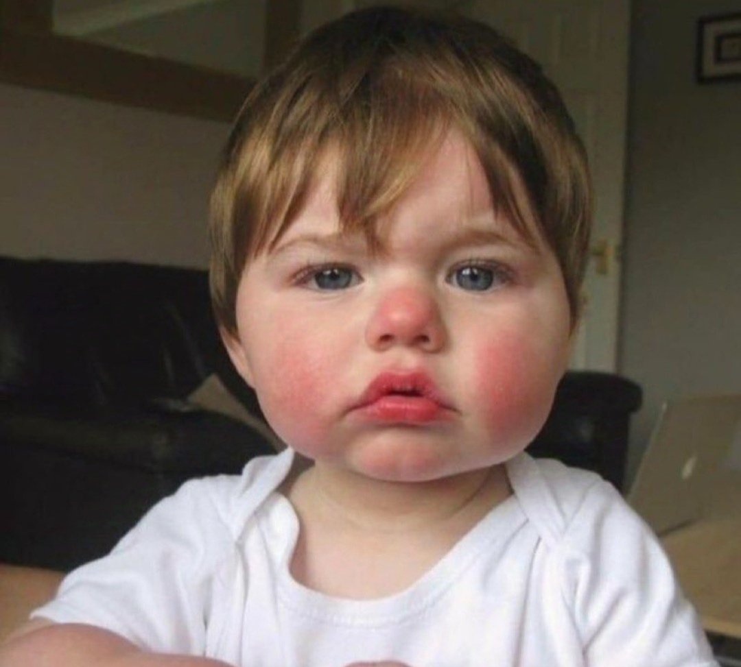 Beyaz tenlisindir:
- Üşümüşsündür
-Utanmışsındır
-Sinirlenmişsindir
-Gülmüşsündür