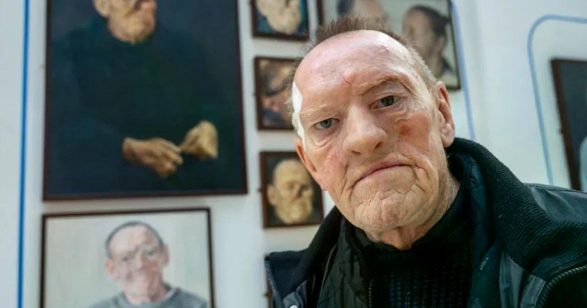 A portrait of Robin is one of 15 unveiled at an exhibition people with injuries who wear prosthetics to replace facial features manchestereveningnews.co.uk/news/greater-m…