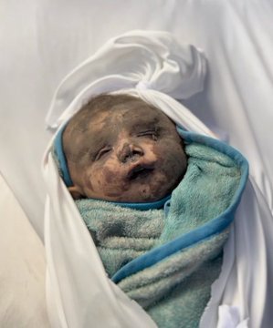 Ziyad_Baybars's tweet photo. Ağladığında Annesi Ağzına Emzik Verecekti. 💔🇵🇸
#SaveTheBabiesOfGaza 
Ülkemde siyonist istemiyorum https://t.co/vSSOSiuPMB