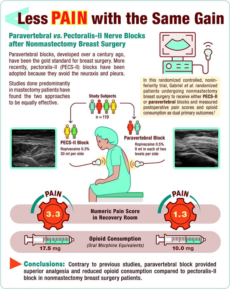 #Infographic in #Anesthesiology - Less Pain with the Same Gain: Paravertebral vs. Pectoralis-II Nerve Blocks after Nonmastectomy Breast Surgery 🎨 ow.ly/Fch050U5tT3