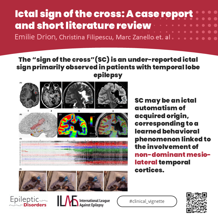Epileptic Disorders tweet media