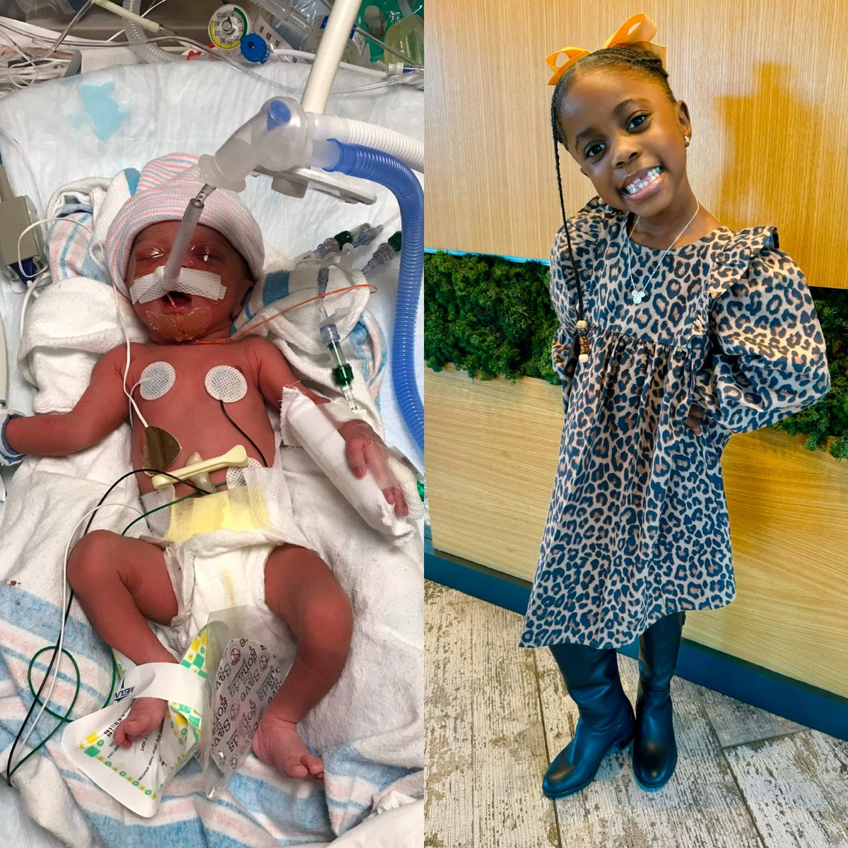 In honor of World Prematurity Day! 

A check-up turned magic, you came in a flash, Fighting so strong, our lives changed in a dash. We weren’t quite ready, but we’d change nothing, Our brave little miracle, you keep our hearts beating!

 #daughterlove #worldprematurityday