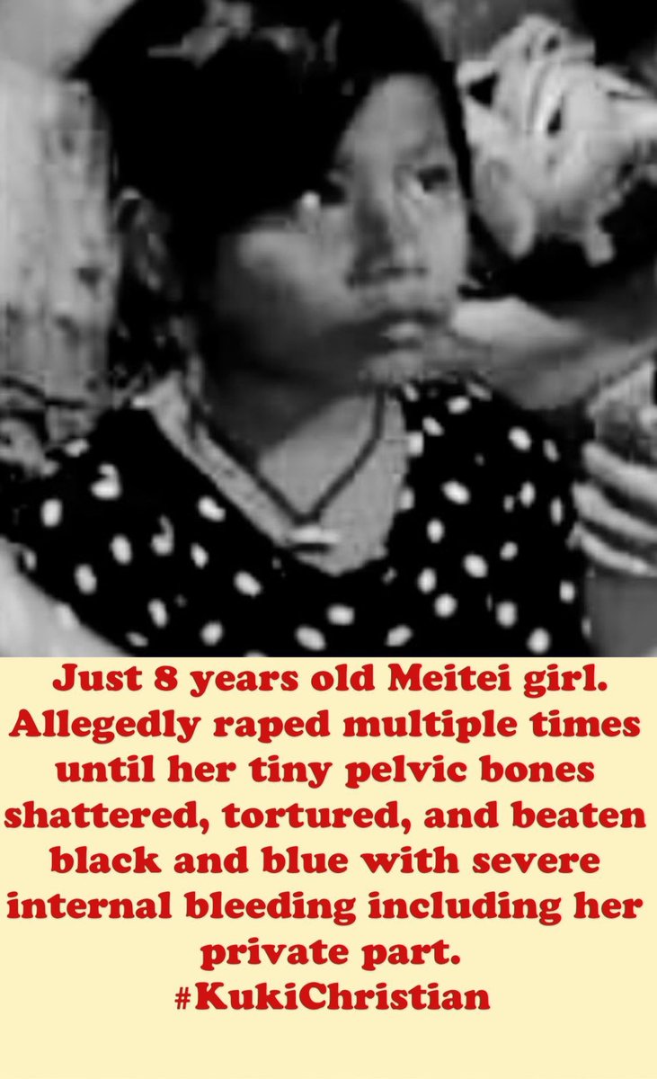 yelhaomee's tweet photo. Time To Eliminate #Cancerous and #Land_Lust_KukiZoNarcoTerrorrists !!!

This is not a crime of --

- #Raped on #Meitei_Hindu_Women but Rape on Our Nation.

- Brutally #Tortured and #Beheaded of #Meitei_Hindu_Kids but of our Nation.

- Crimes against #Women and #Children of #Meitei_Hindu_Civilians but on our Nation.

- Attack on #Meitei_Hindu_Community But Attack on Our Nation by Transnational illegal Immigrants Burmese back #Christian #KukiZoNarcoTerrorist.

This is a ruthless assault on our Nation, targeting not just the #Meitei_HinduCommunity but also the #Meitei_Baptist_Christians by devastating destruction and Arson the  #Meitei_Baptist_Churches. These heinous crimes are an affront to humanity, violating our collective values and sense of decency.

It's unacceptable that Transnational illegal immigrants and #KukiZoNarcoterrorist groups continue to perpetrate violence on our Nation. We must unite against this Senseless Brutality and demand justice for the victims. It's time to stand strong against this #Cancerous and #Land_Lust NarcoTerrorist Community and Protect our Nation's value.

#Justice4MeiteiHostages
#SaveMeiteiMeetei
#SaveMeiteiHindu
#SaveManipur
#SaveIndia
#SaveOurNation from
#KukiBabyKillers
#KukiZoRappistNarcoCommunity

@USCCR @ACLU @NHRCIndia @EHRC @CdnHumanRights @AusHumanRights @UNHumanRights @UNICEF @amnesty @HMOIndia @official_dgar @Spearcorps @easterncomd @NIA_India @Republic @CBIHeadquarters @htTweets @vijaita @DeccanHerald @DeccanChronicle @ZeeNews @republic @NELiveTV @ABPNews  @CNNnews18 @News9Tweets @newslaundry @CRUXX_Ind   @NENowNews @kartikeya_1975 @vijaygajera @Deblinabose17 @TimesAlgebraIND @rashtrapatibhvn @PMOIndia @AmitShah @narendramodi @NBirenSingh @ndtvfeed @ndtv @thewire_in @KaranThapar_TTP @EastMojo @AJEnglish @timesofindia @TimesNow @hindupost @NepCorres