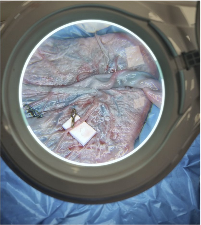 Neurosurgery Publications (@neurosurgerycns) on Twitter photo #GlobalNeurosurgeryEssentialsReviewSeries Education and Training in Global Neurosurgery: The Quest for Diversity and Equitable Collaborations by <a href="/Thango02/">Nqobile Thango✨</a> et al <a href="/UCT_news/">UCT</a> <a href="/ronibats/">Ronnie E. Baticulon</a> <a href="/RoxannaMGarcia/">Roxanna Garcia MD MS MPH</a> <a href="/ag_kolias/">Angelos Kolias</a> <a href="/NathanShlobin/">Nathan Shlobin, MD MBA 🇺🇦</a> <a href="/KemelG/">Kemel A. Ghotme, MD, PhD</a> <a href="/grosseaumd/">Gail Rosseau</a> <a href="/LuisBorbaNeuroc/">Luis A B Borba, MD PhD, IFAANS</a> <a href="/CNS_Update/">CNS</a> #GlobalNeurosurgeryEssentialsReviewSeries Education and Training in Global Neurosurgery: The Quest for Diversity and Equitable Collaborations by <a href="/Thango02/">Nqobile Thango✨</a> et al <a href="/UCT_news/">UCT</a> <a href="/ronibats/">Ronnie E. Baticulon</a> <a href="/RoxannaMGarcia/">Roxanna Garcia MD MS MPH</a> <a href="/ag_kolias/">Angelos Kolias</a> <a href="/NathanShlobin/">Nathan Shlobin, MD MBA 🇺🇦</a> <a href="/KemelG/">Kemel A. Ghotme, MD, PhD</a> <a href="/grosseaumd/">Gail Rosseau</a> <a href="/LuisBorbaNeuroc/">Luis A B Borba, MD PhD, IFAANS</a> <a href="/CNS_Update/">CNS</a>
