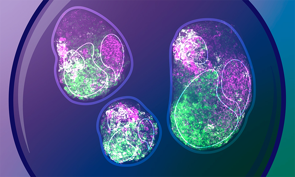 EMBL (@embl) on Twitter photo Did you know that we all start life as a symmetric ball of cells? Later, a process called gastrulation breaks this symmetry and sets up our body plan.
<a href="/EMBLBarcelona/">EMBL Barcelona</a> researchers have revealed how cells can behave autonomously during this process.
embl.org/news/science-t… Did you know that we all start life as a symmetric ball of cells? Later, a process called gastrulation breaks this symmetry and sets up our body plan.
<a href="/EMBLBarcelona/">EMBL Barcelona</a> researchers have revealed how cells can behave autonomously during this process.
embl.org/news/science-t…