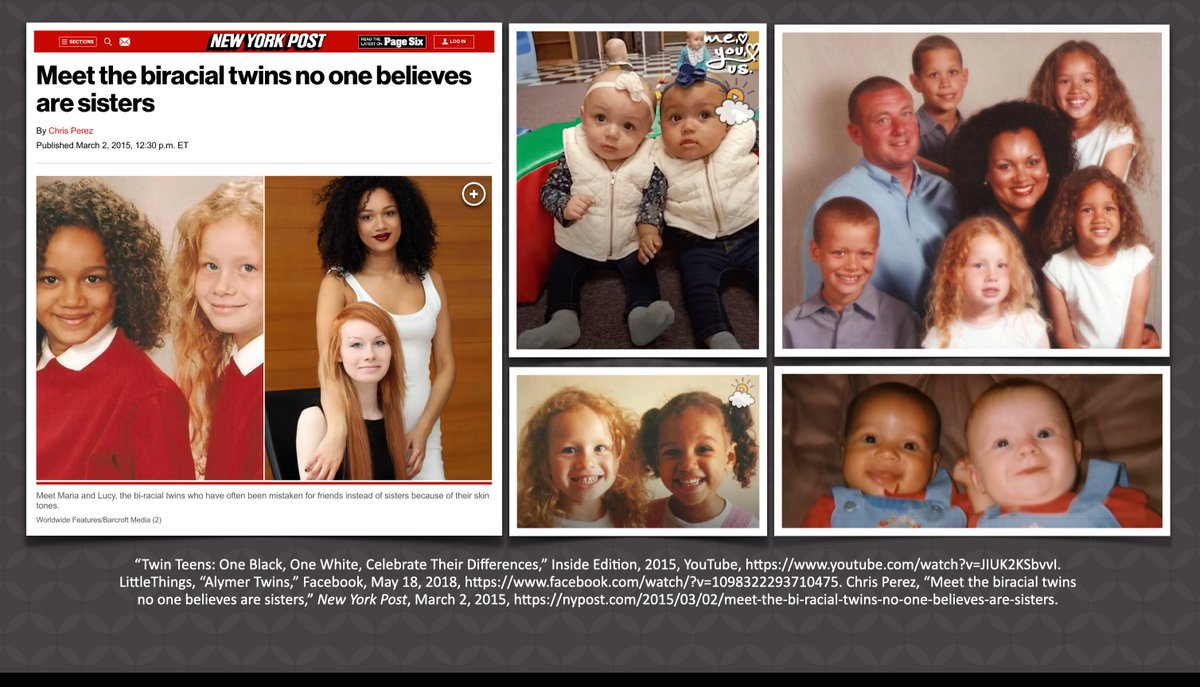 aigkenham's tweet photo. This news item once again reminds us that all humans belong to one race--we're all descendants of Adam. The Human Genome Project confirmed this in 2000.  Yes, the science of genetics confirms there's only one human race.

Note the article refers to the skin "tones" of these twins.  And this is the correct way of describing their skin as they have different shades because all humans have the same basic skin color brown.  This is due to the main skin pigment being melanin, a brown pigment. All humans are shades of brown from dark to light. It all depends on the gene combinations for the amount of melanin produced in our skin.

Yet in the article they also refer to them as "black" and "white."  But no one is truly black or white, we are all shades of brown.

Also the article calls them "bi-racial twins."  But they are not "bi-racial" as all humans belong to one race.  There are no bi-racial people or bi-racial marriages.

Such dark and light twins are not uncommon.  There have been many similar examples from around the world.

Remember, "“And he made from one man every nation of mankind to live on all the face of the earth, having determined allotted periods and the boundaries of their dwelling place,” (Acts 17:26).