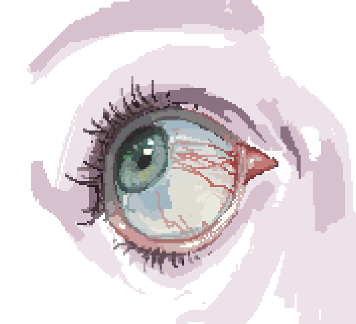 eye strain